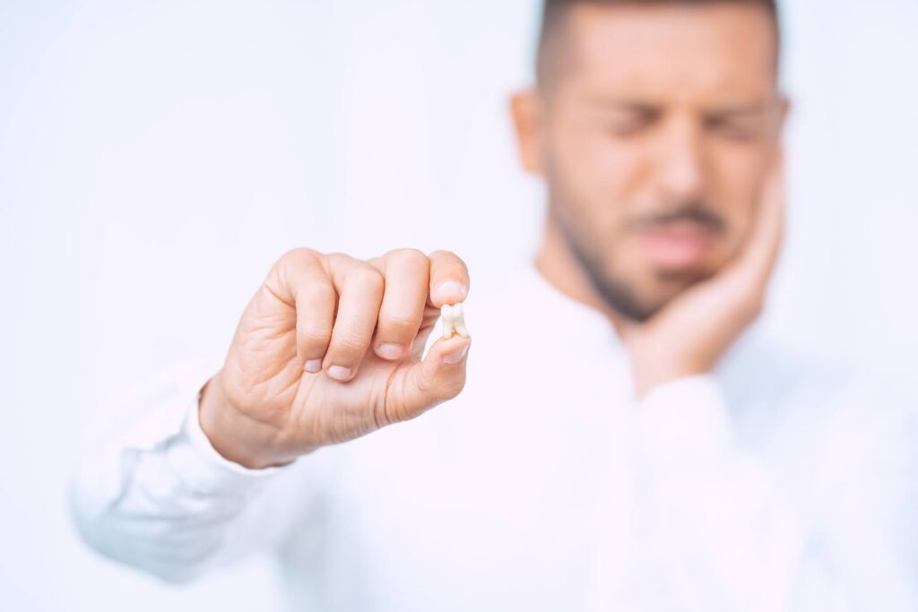 A man holding his wisdom tooth after extraction