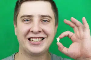 Windsor wisdom teeth removal