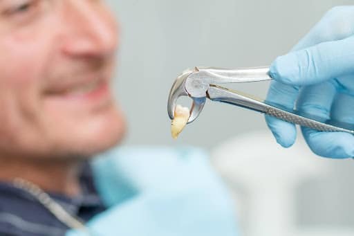 Wisdom tooth removal with expert oral surgery