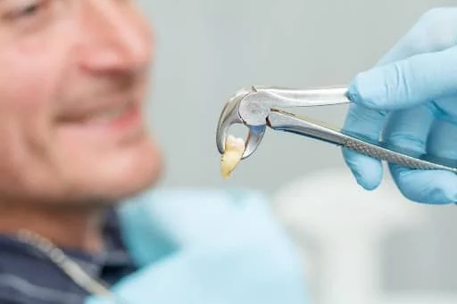Wisdom tooth removal with expert oral surgery